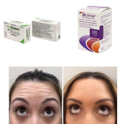 100 Unit Korea BTX Botulinum Toxin untuk Kerutan dan Garis halus