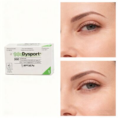 Dysport Type A Injection Dysport 500Unit High Purity Toxins Remove Wrinkles