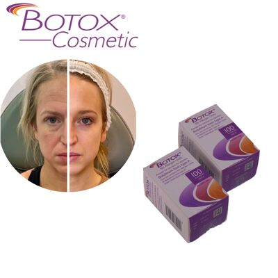 Toksin Botulinum Botox Allergan Treatment Botox tipe A 100IU Haluskan kerutan untuk Wajah