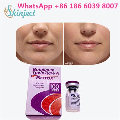 Toksin Botulinum ALLERGAN BOTOX Durasi 4 hingga 6 Bulan 100 Unit Tipe A