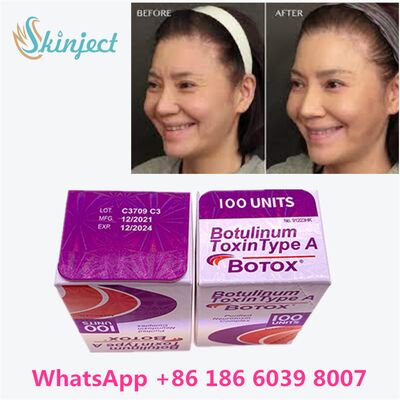 Botox Allergan Botulinum Toxin Tipe A 100 Unit untuk Menghilangkan Kerutan dengan Durasi 4~6 Bulan