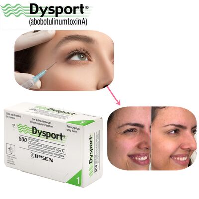 500u Dysport Penghilang Kerutan Wajah Bubuk Liofilisasi Pemrosesan Kustom OEM Dysport
