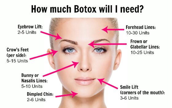 Alergen Salon Kecantikan Korea Botulinum Toxin Untuk Anti Penuaan Dan Menghilangkan Kerut