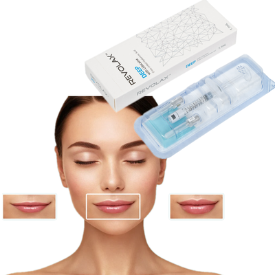 OEM 1.1ml Revolax Fine Deep Sub-Q Lightweight Dermal Filler untuk garis halus dan peremajaan kulit halus