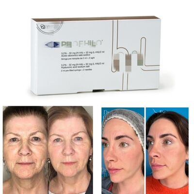 Perawatan Profhilo Hyaluronic Acid Skin Booster & Bio-Remodelling