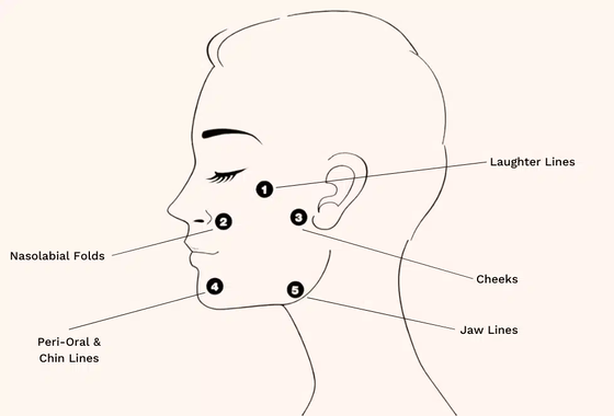Perawatan Profhilo Hyaluronic Acid Skin Booster & Bio-Remodelling