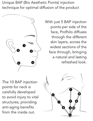 64mg Anti-penuaan konsentrasi tinggi (1x2ml) Profhilo H+L Bio-remodeling Injectable Dermal Filler
