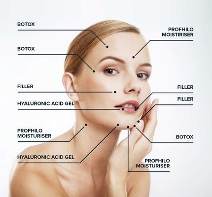 64mg Anti-penuaan konsentrasi tinggi (1x2ml) Profhilo H+L Bio-remodeling Injectable Dermal Filler