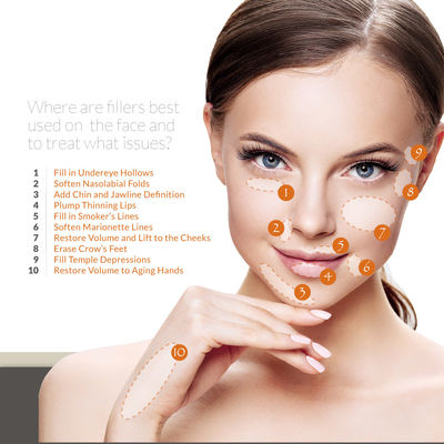 Skinject Hyaluronic Acid Gel Filler Injeksi Menghilangkan Kerut Dahi