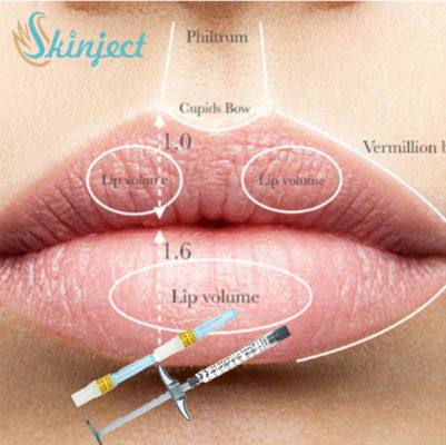 Full Lip Cheek Injectable Dermal Filler Asam Hyaluronic HA Filler 1ml 2ml 5ml