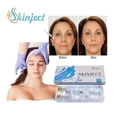 Skinject 1ml Pengisi Asam Hyaluronic Halus Anti Penuaan Anti Kerut Injeksi Dermal Filler