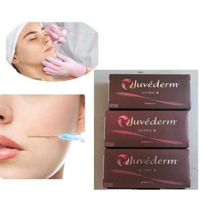 Injeksi Juvederm 2x1ml Ultra 3 Pengisi Kulit Bibir 24mg/Ml