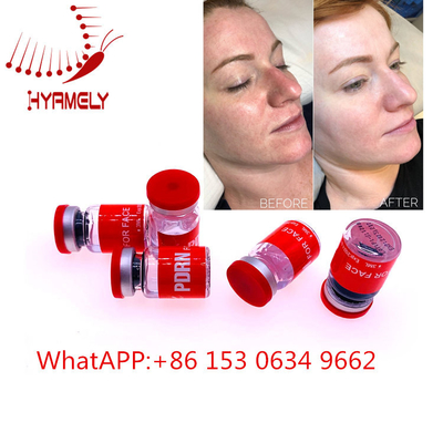Anti Penuaan Meso Serum Injeksi Dengan Hyaluron Pen Dermal Filler