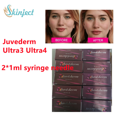 Juvederm Hyaluronic Acid Dermal Filler Juvederm Lip Filler Dengan  2x1ml Ultra3 Ultra4
