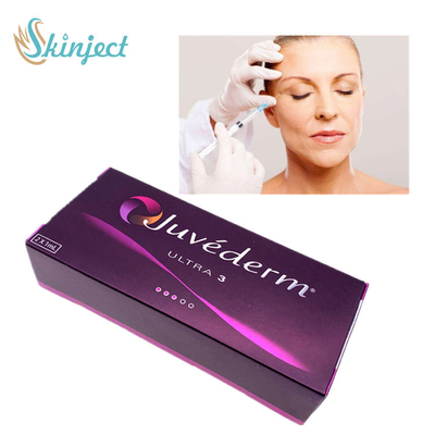 Juvederm Ultra 3 injeksi asam hialuronat pengisi wajah injeksi pengisi kulit