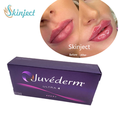 Juvederm 2*1ml Pengisi Bibir Pengisi Kulit Asam Hyaluronic Dengan Lido Ultra4