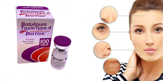 Alergan Botulinum Toxin Tipe A Bentuk Bubuk