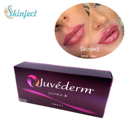 Juvederm Ultra3 2x1ml Pengisi Wajah Asam Hyaluronic Dermal