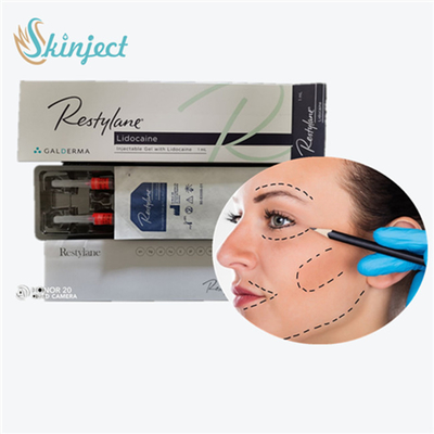 Cross Linked Dermal Filler  LYFT Untuk Pengisian Garis Dahi