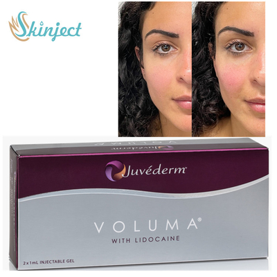 Juvederm Voluma 2x1ml HA Dermal Fillers untuk Kontur Tulang Pipi Dagu