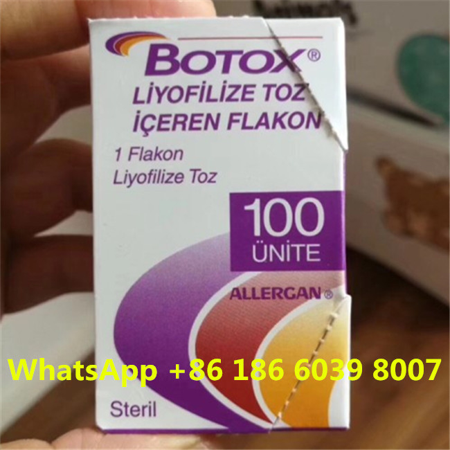 Injeksi Alergan  Botulinum Toxin Tipe A 100 Unit Penghapusan Keriput