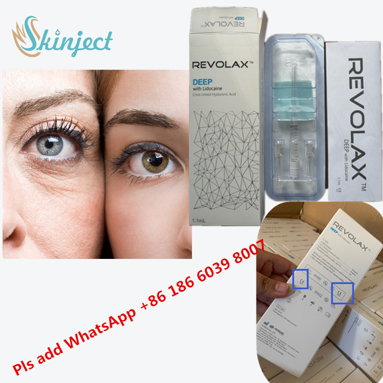 Pengisi Dermal Tautan Silang Pengisi Revolax Penghubung Silang HA Asam Hyaluronic 24 Mg/Ml