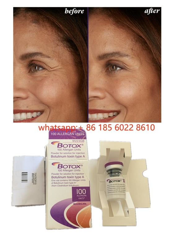 Produk kecantikan Allergan 100unit Botulinum Toxin  Untuk Kerutan Wajah Filler Kulit