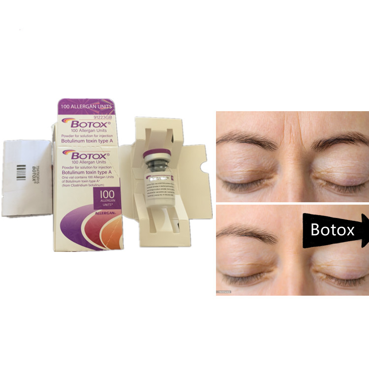 Allergan 100ui Botulinum Toxin Serum Anti Aging Produk Untuk Dysport Wajah
