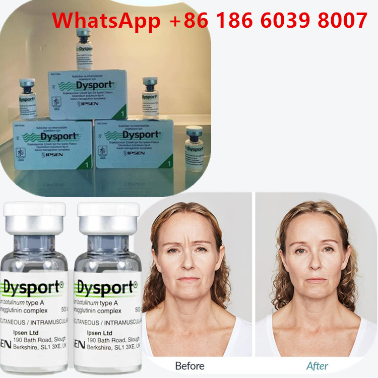 Botulinum Toxin Type A 100 Unit  Injeksi Untuk Kerutan Wajah