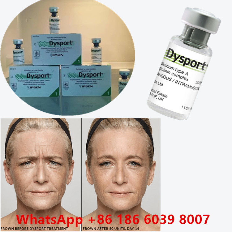 Botulinum Toxin 100 Unit BTX Injeksi Tipe A Penggunaan kosmetik