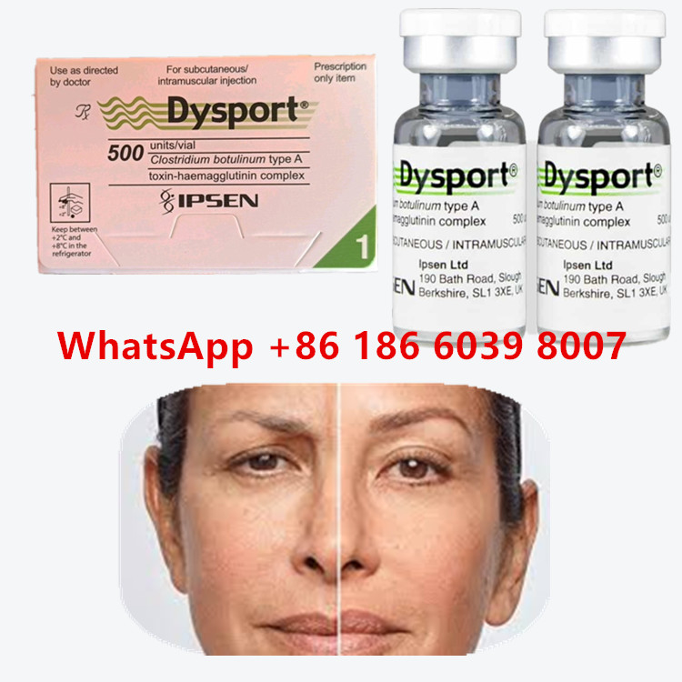Botulinum Toxin Dysport 100u Clostridium Botulinum Tipe A Untuk Anti-penuaan kerutan wajah