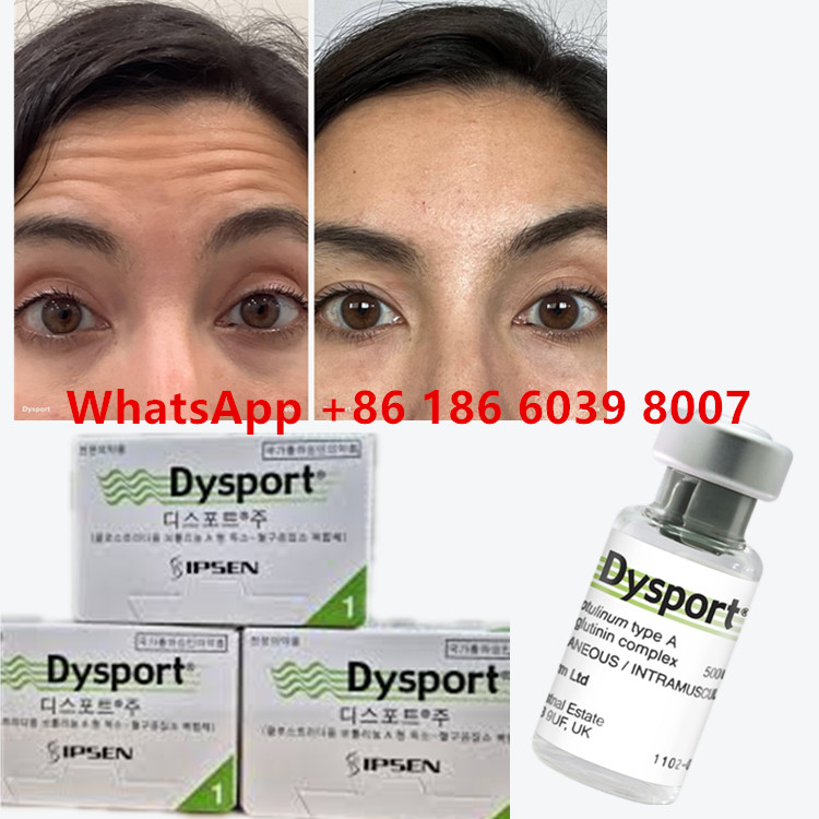 Botulinum Toxin Dysport Clostridium Botulinum Type A 500 Unit/ vial Untuk Garis-garis Merah