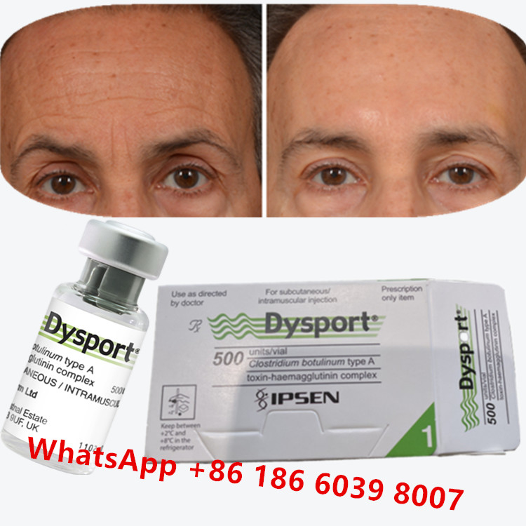 Botulinum Toxin Dysport Clostridium Botulinum Tipe A Untuk Kaki Kerbau
