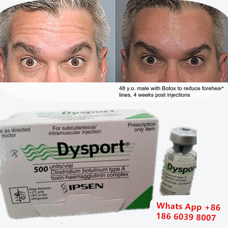 Botulinum Toxin Dysport Botox Clostridium Botulinum Tipe A Untuk Lift alis