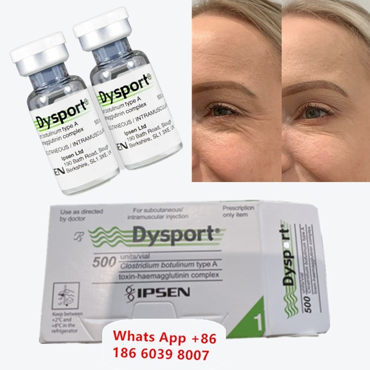Toksin Botulinum Tipe A Dysport untuk Kerutan Tear Trough