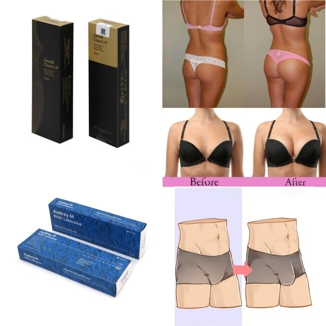 Pengisi Asam Hyaluronic Murni 10 Ml 20 Ml Untuk Pembesaran Payudara Dan Bokong