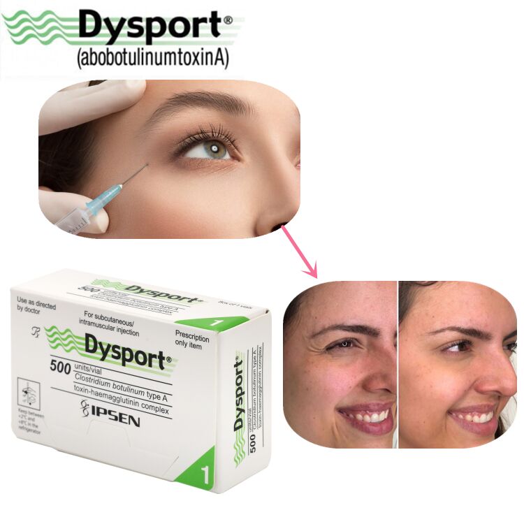 500u Dysport Penghilang Kerutan Wajah Bubuk Liofilisasi Pemrosesan Kustom OEM Dysport