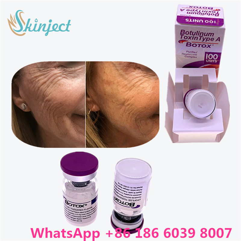 Botulinum Toxin Allergan Botox White Powder Pengobatan Efektif untuk Garis Wajah dan Relaksasi Otot di Medis