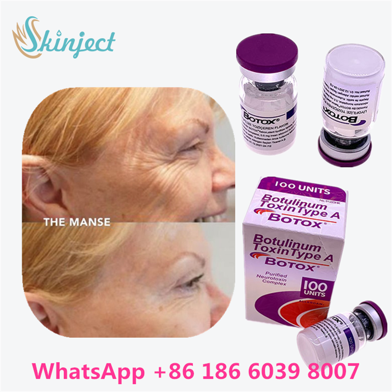 Toksin Botulinum BOTOX Kosmetik 100 Unit Allergan OnabotulinumtoxinA untuk Kerutan Wajah
