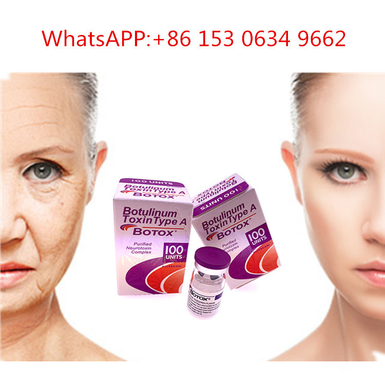 50u 100u 150u Tipe A Alergan  Injection Botulinum Toxin Untuk Anti Kerut