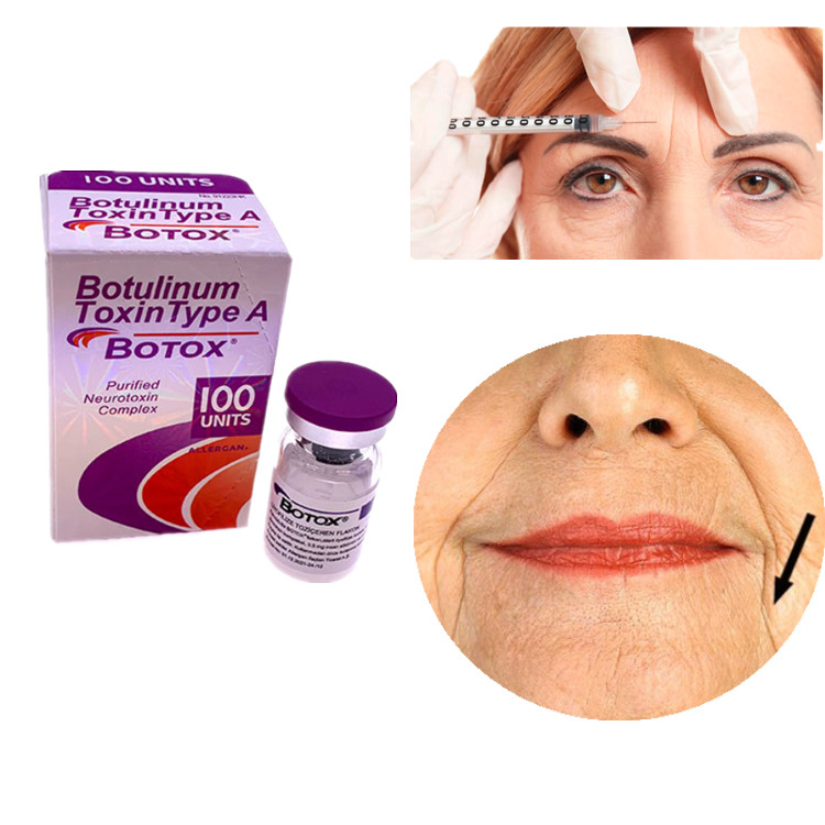 Allergan Botox 100IU Botulinum Toxin Tipe A Untuk Menghilangkan Kerutan Wajah Dan Mata