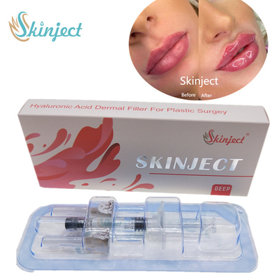 Skinject Deep Hyaluronic Acid Dermal 2ml Pengisi Bibir Suntik