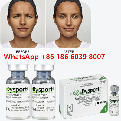 Botulinum Toxin Injeksi Kosmetik  Untuk Peremajaan Wajah