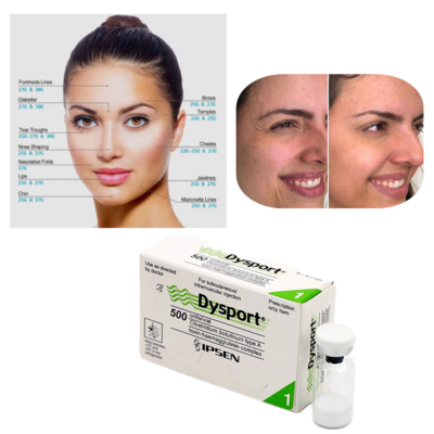 Dysport 500U Botulinum Toxin Type A untuk Pengobatan Kerutan