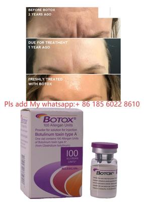 Suntikan Botox Allergan Botulax Toksin Botulinum Hilangkan Kerutan